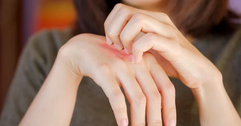 Hands Breaking Out From Gloves - USAMED Medical Distributors