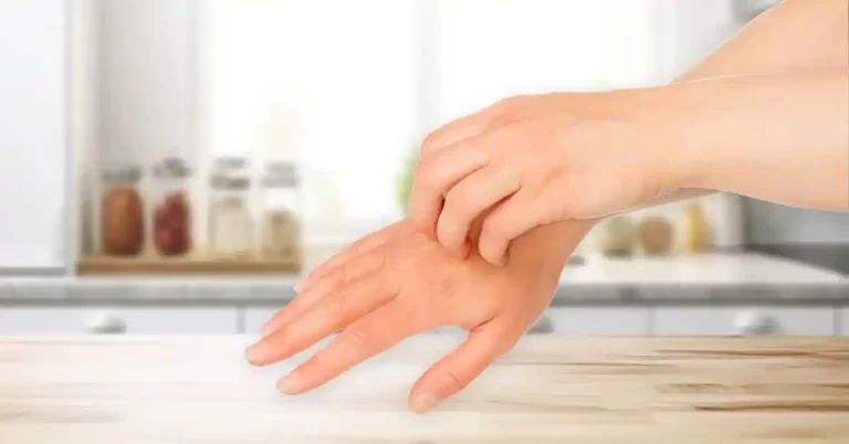 treating latex allergy rash USAMED Medical Distributors